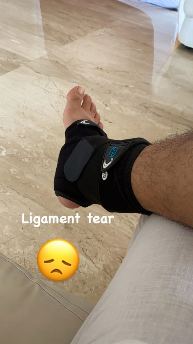 Arjun Bijlani suffers a ligament tear on his Goa vacation