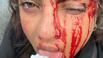 Priyanka Chopra is bloodied and bruised as she enjoys ice-cream on the sets of Citadel